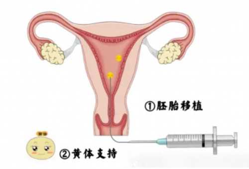 男性不育