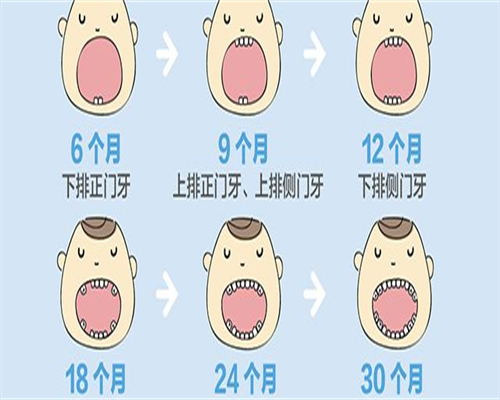 输卵管通而不畅不孕